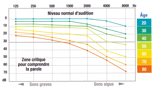 Audiogram / audiogramme